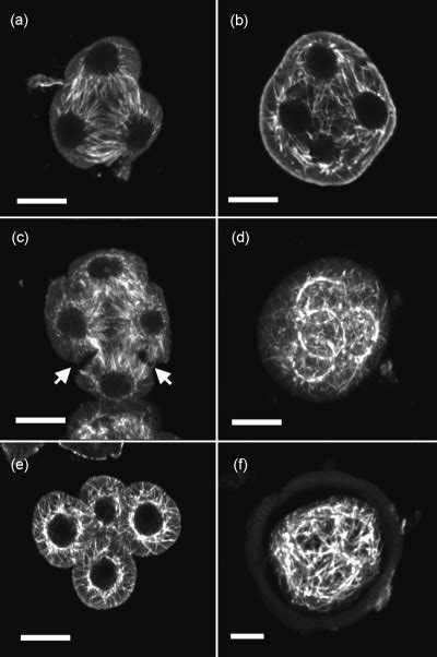 TETRASPORE Encodes A Kinesin Required For Male Meiotic Cytokinesis In