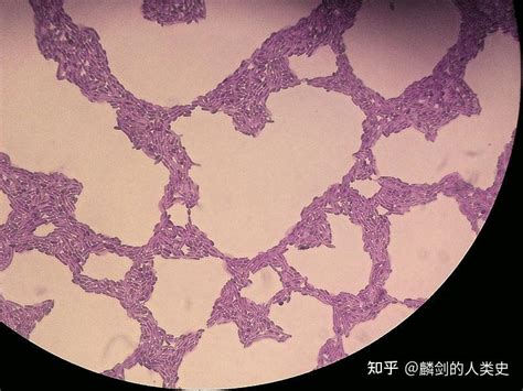 【地球生物全系列——从单细胞到人类】担子菌门—柄锈菌亚门 知乎