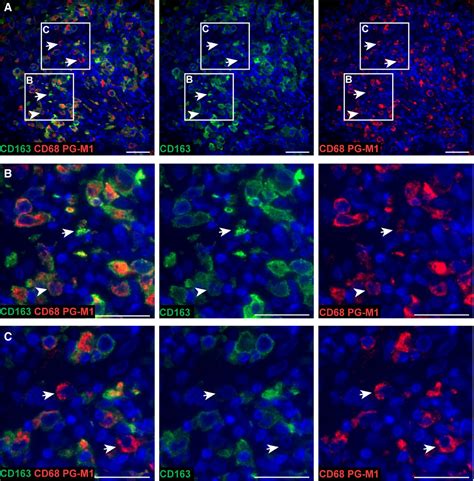 Macrophage Histology Em
