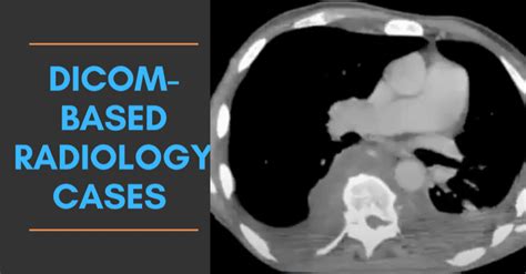 Dicom Radiology Cases Set Cases Radiogyan