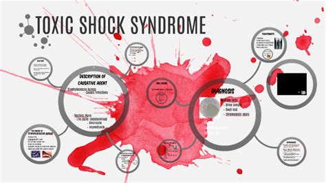 Toxic Shock Syndrome By Kimberly Roberts On Prezi