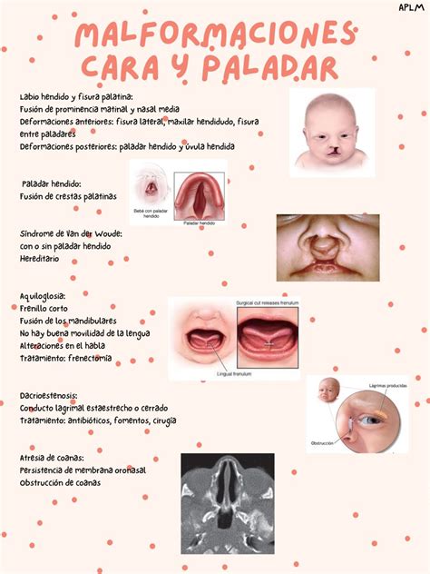 Malformaciones cara y paladar Odontología Pediatría Antibioticos