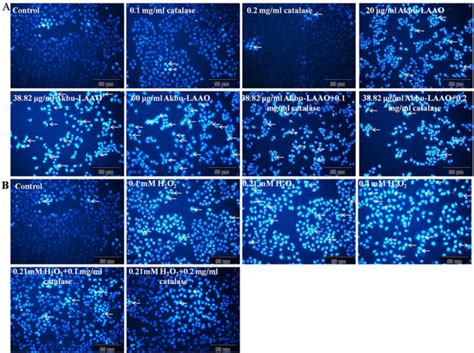 Hoechst 33258 Staining Assay Of HepG2 Apoptosis To The Stimulations Of