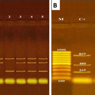 Agarose Gel Electrophoresis Of Multiplex PCR A Virulence Genes For