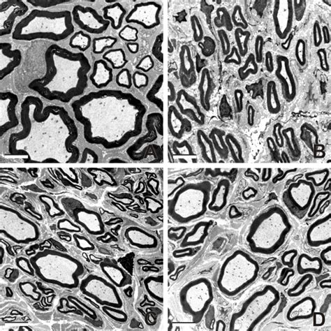 Representative Ultrathin Sections Through Mcn Electron Micrographs