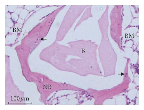 Photomicrographs Showing Bone Formation In Different Groups A B