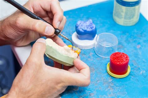 Dental Technician Modeling A Wax Bridge Stock Image Image Of Oral