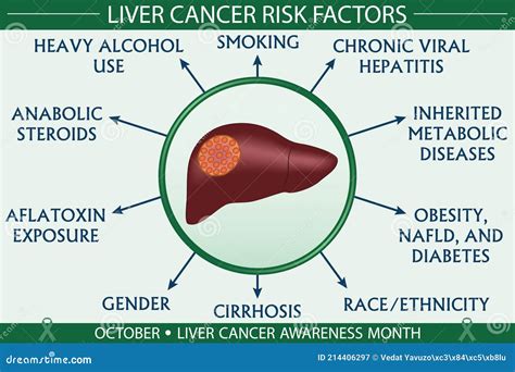 Liver Cancer Disease Risk Factors Infographic Vector Illustration Stock Vector Illustration