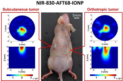 FMT Images Of A Tumor Bearing Mouse Using NIR 830 ATF68 IONP