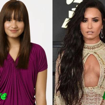 Demi Lovato Plastic Surgery: An Improvement For A Young Star