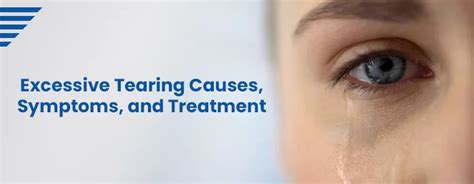 excessive tearing  symptoms  treatment