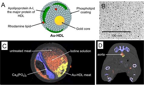 Nanoparticle Contrast Agents For Computed Tomography A Focus On