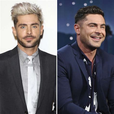 Zac Efron Aclara Si Se Hizo Cirugía En La Cara