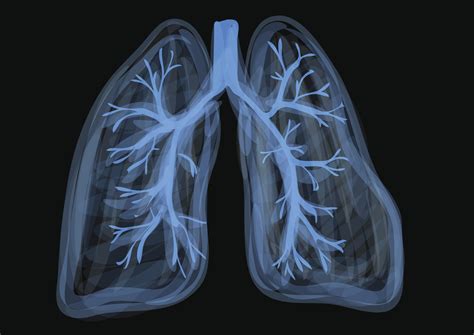 Unhealthy Healthy Lungs Xray - bmp-park