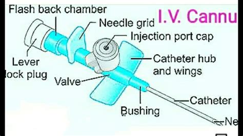 Ivcannula Parts Name Youtube