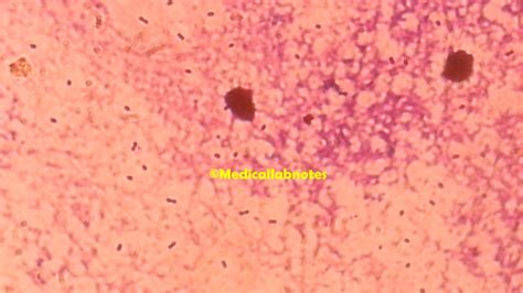 Streptococcus Pneumoniae Introduction Morphology Pathogen