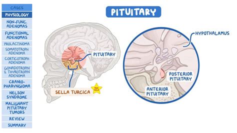 Pituitary Tumors Pathology Review Video Anatomy Osmosis