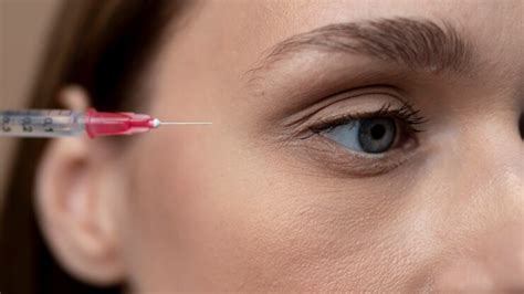 PRP Under Eyes Before And After Queries PRP Treatment