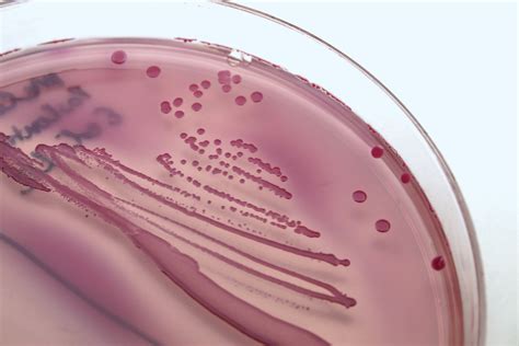 E Coli Pathogenic Infection Contamination Britannica