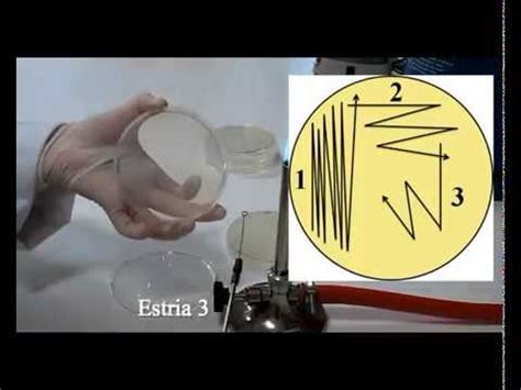 T Cnicas B Sicas De Microbiolog A Aislamiento Y Siembra En Estr A De