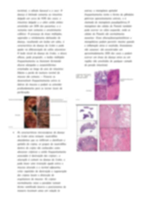 SOLUTION Patologia intestino delgado e cólon Studypool