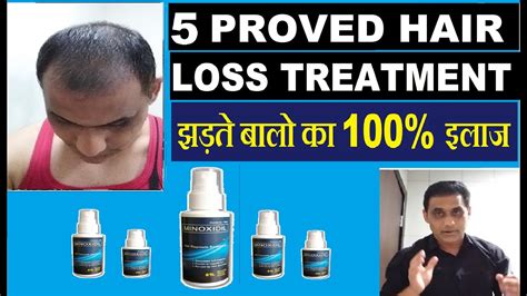 5 Proven Hair Loss Treatments For Men Baldness Cure And Hair Fall