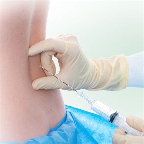 Epidural Needle