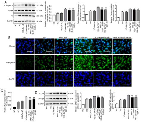 Yap Promotes High Glucoseinduced Inflammation And Extracellular