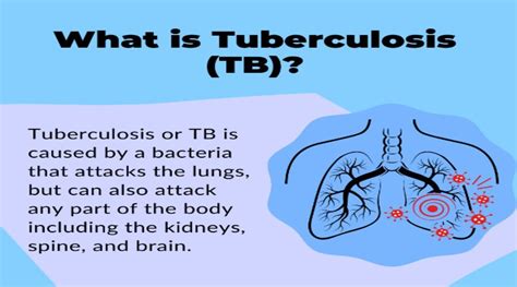 Tuberculosis Causes Symptoms Treatment And Prevention