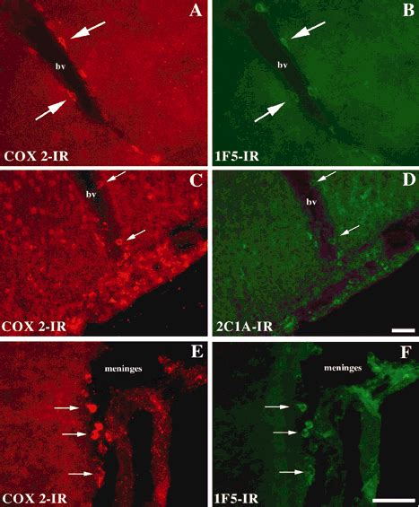 Series Of Fluorescence Photomicrographs Demonstrating The Distribution