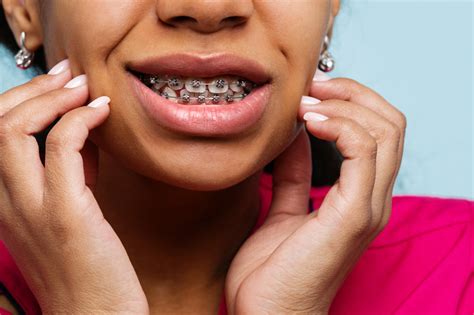 Orthodontic Myths Debunked Facts About Treatment