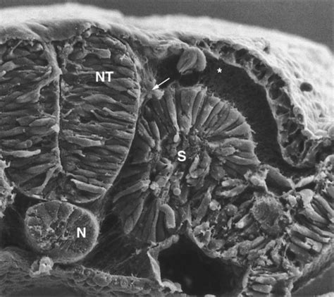 Neural Crest Basicmedical Key