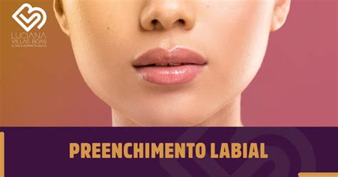 Preenchimento Labial 8 Principais Dúvidas