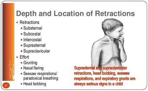 Respiratory Lecture Nurs 3340 Fall 2017