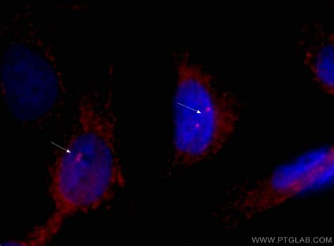 Gamma Tubulin Antibody Cl594 66320 Proteintech