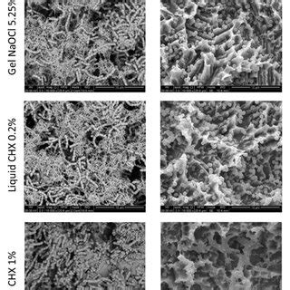 SEM images (magnification ×10,000) of S. mutans and P. gingivalis ... 