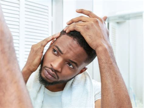 Wart On Scalp Causes Side Effects Risks And Treatment