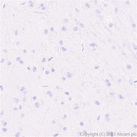 Anti Tenomodulin Antibody EPR27069 160 BSA And Azide Free AB315997