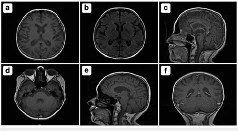 Mri With And Without Contrast In Seven Sections Indicating A Interval