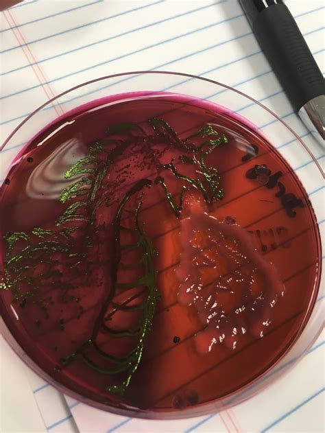 E. Coli on EMB plate : r/microbiology