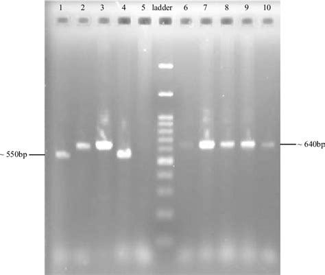 Figure 1 From Isolation Identification And Screening Of Actinobacteria