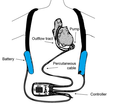 Air Care Series Man Meets Machine — Taming The Sru