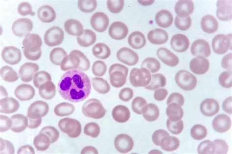 Neutrophil Cell In Blood Smear Stock Photo Image Of Pathology