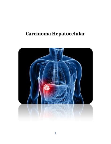 Carcinoma Hepatocelular Pdf