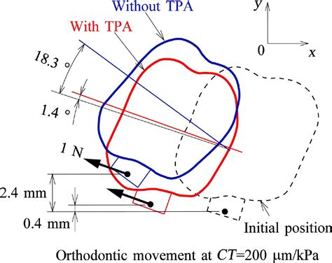 Effects Of Transpalatal Arch On Molar Movement Produced By Mesial Force