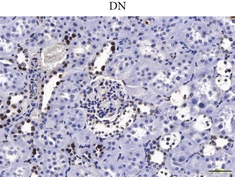 Renal Cell Apoptosis Was Detected By The Tunel Assay Ac And