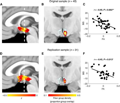 Association Of Inferior Nacc Tract Coherence With Trait Impulsivity Is