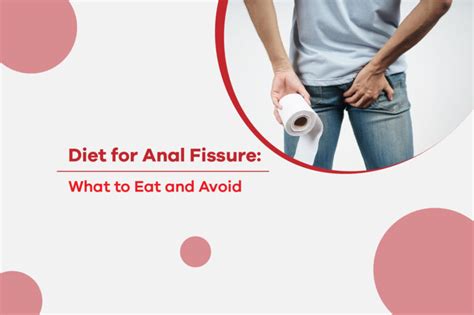 Diet For Anal Fissure What To Eat And Avoid