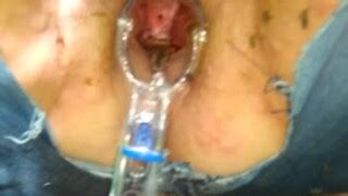 Outdoors Played With My Wife S Pussy Women Naked With Insects MOTHERLESS