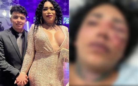 Paola Suárez es hospitalizada tras ser GOLPEADA por su prometido Fama